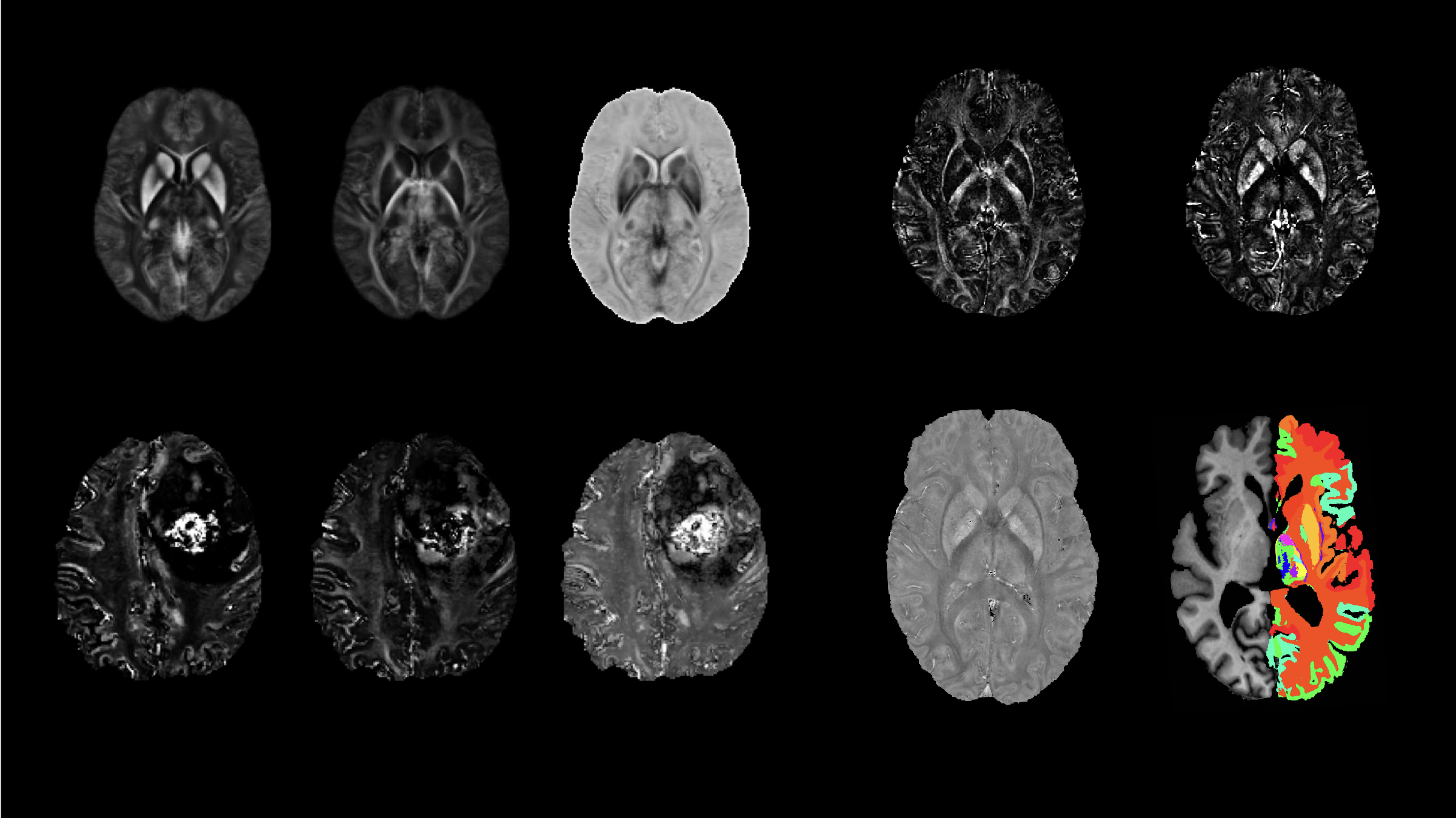Magnetic Susceptibility in MRI